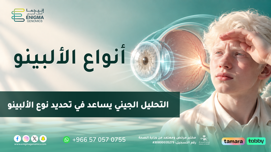 أنواع الألبينو وكيف يساعد التحليل الجيني في تحديد النوع