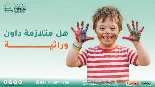 هل متلازمة داون وراثية