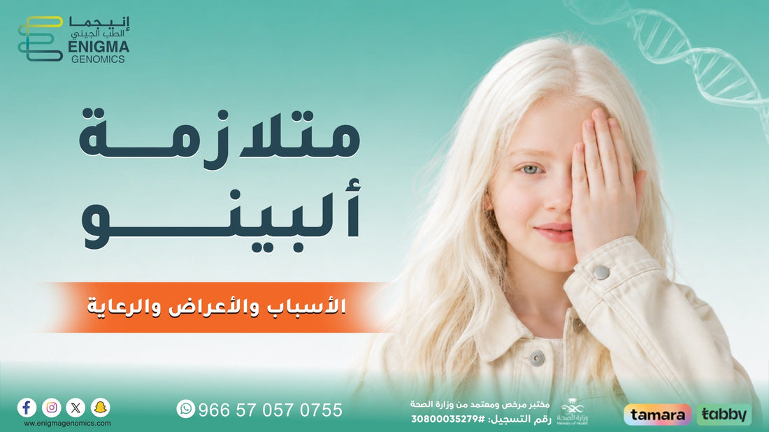 ما هي متلازمة ألبينو الأسباب والأعراض وطرق التشخيص والرعاية