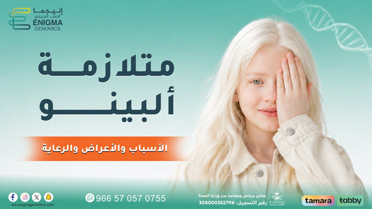 ما هي متلازمة ألبينو الأسباب والأعراض وطرق التشخيص والرعاية