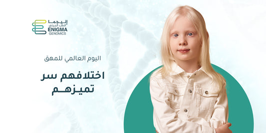 Albinism Genetics and diagnosis